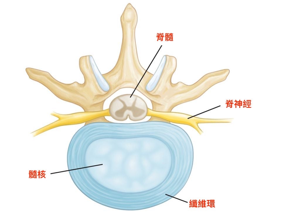 椎間盤突出-症狀與治療-腳麻-下背痛-坐骨神經痛推薦必看-脊椎剖視圖-可看出脊髓脊神經與椎間盤髓核